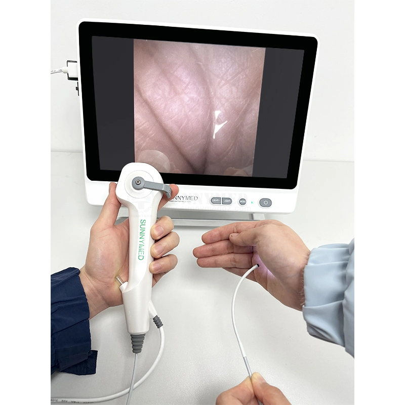 Sy-P029-3 ureteroscopio flexible médicos precios baratos de un solo uso piedras ureteral ureteroscopio en venta