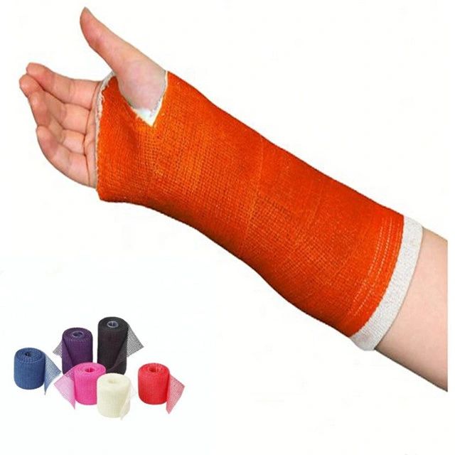 Waterproof Arm Cast Cover Orthopedic External Fixation Medical Fiberglass Casting Tape