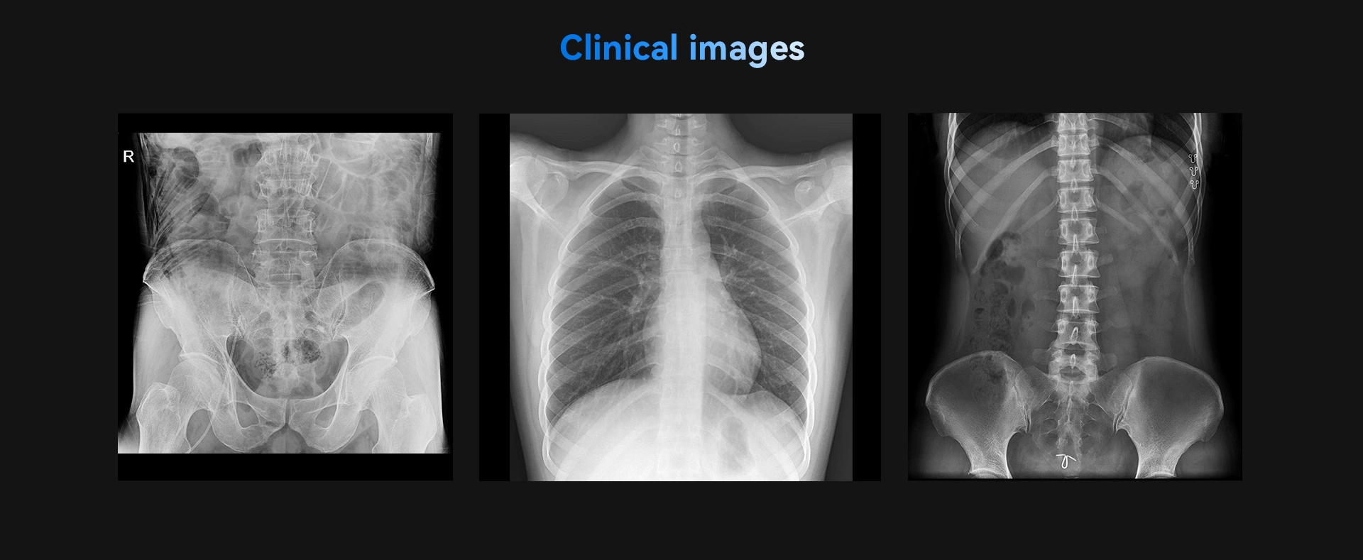 Populaire Hot Selling X-ray machine pour l'examen tout le corps avec Chariot mobile