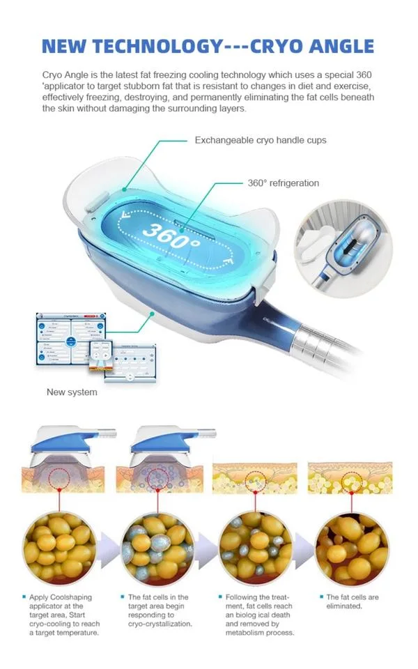 New Fat Freezing System Neck and Chin Hand Held Weight Loss Belly Fat Freeze Equipment