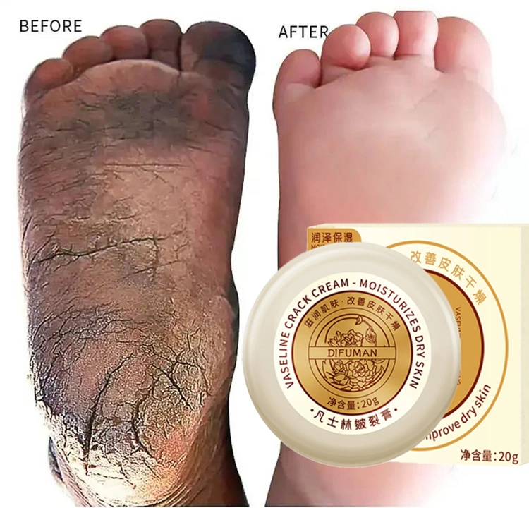 Low MOQ Custom Logo Anti Dry Heels Cuidado de los pies agrietados Crema intensiva Moisturizing Whitening Reparación de pie Crema