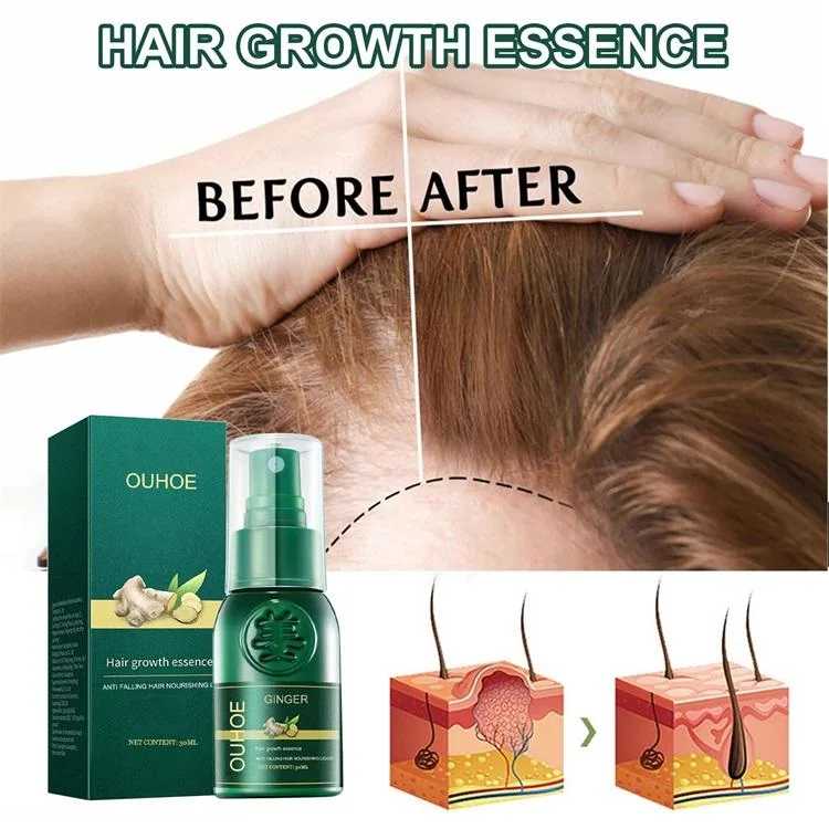 Anti Loss Ginger Serum Hair Growth Essence Spray