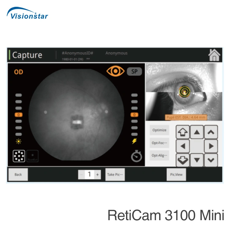 Reticam 3100 (модель B) дна матки пациентки флюоресценция ангиографии дна матки пациентки камеры и ФФА