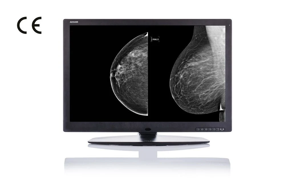 30inch 10MP High Resolution Display System for X-ray Medical Device, CE