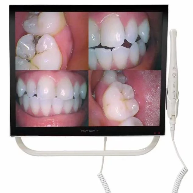 جهاز مراقبة رقمي جديد بحجم 17 بوصة Dental Intraual Camera مع زجاج مصفح