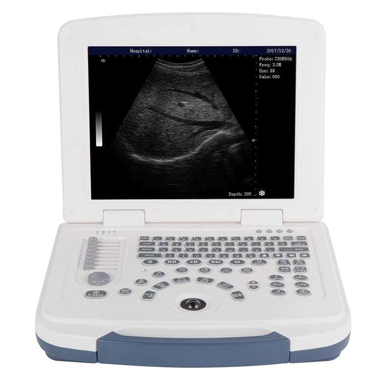 Computadora portátil de alta calidad Mecanmed 4D aparato de escáner equipos hospitalarios Ultrasound Con carrito