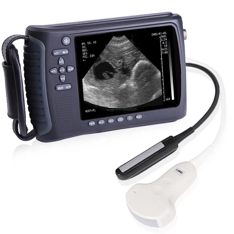 Affordable and Efficient Vet Ultrasound for Veterinary Animal Clinics & Hospitals