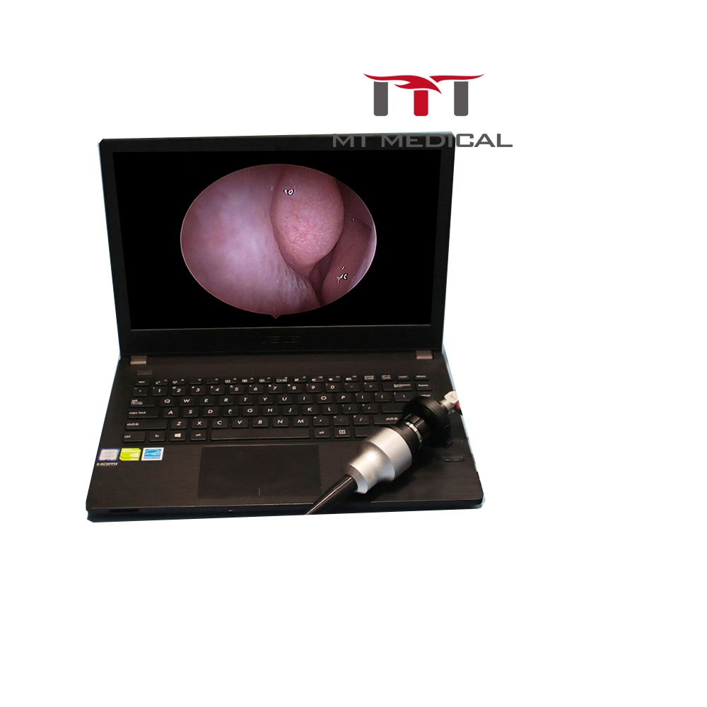 Fuente de luz LED médicos Cirugía Plástica de la Cámara de endoscopia endoscopia artroscopio Ent Ginecología Hysteroscope cámara