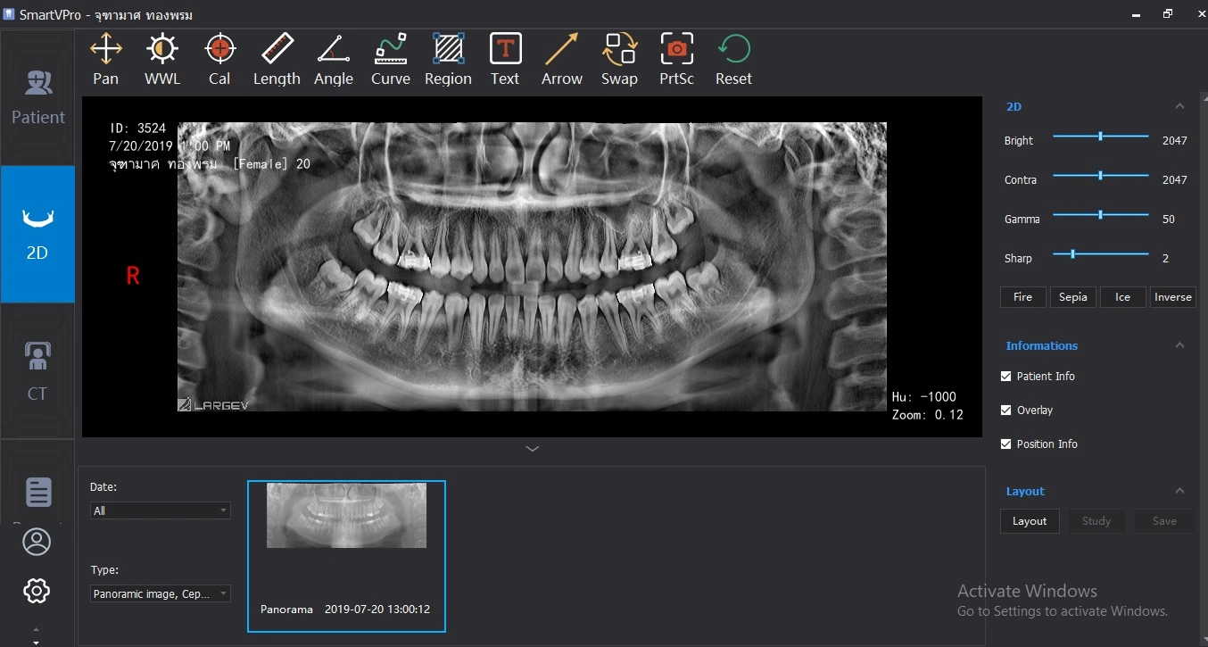 Smart 3D-X Dental Röntgenstrahler-CT mit niedriger Dosis