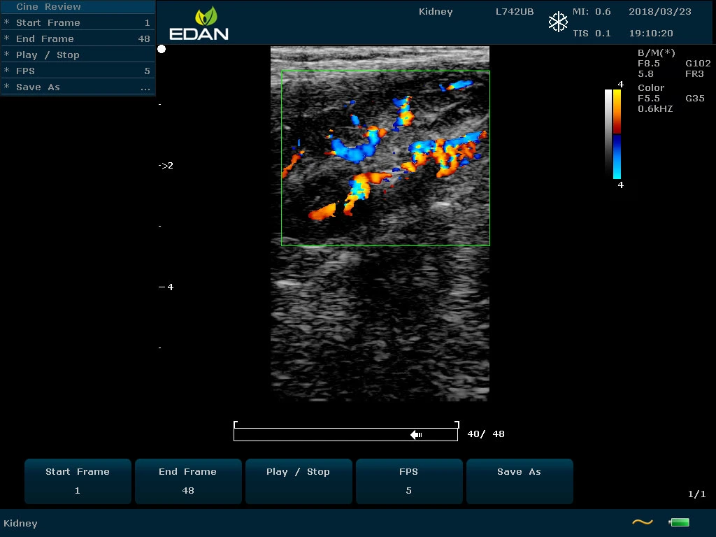 Edan Veterinary Color Doppler with Convex/Linear/Micro-Convex Probe U60 Price