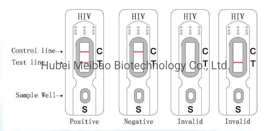 Medizinische Versorgung One Step Rapid Test HIV Vollblut/Serum/Plasma Test