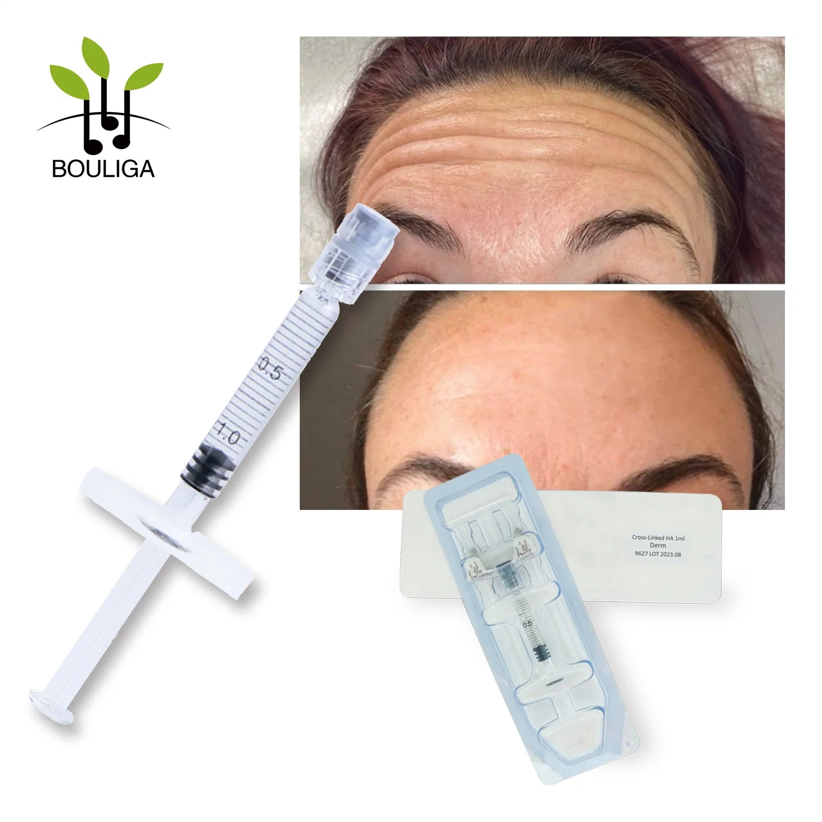 1ml Injection Faciale Anti-Rides Dermal Filler à l'Acide Hyaluronique