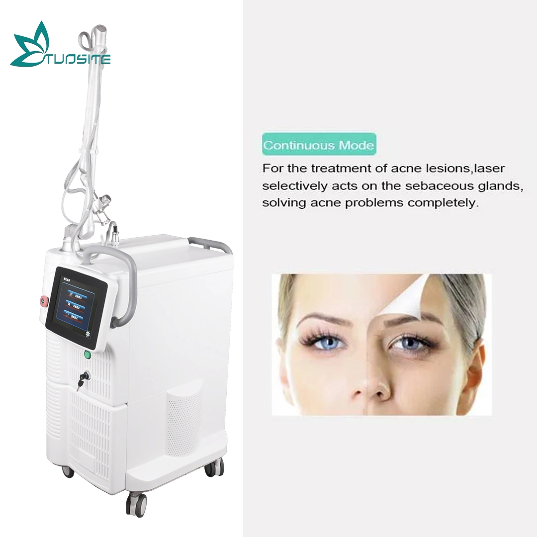 RF Tube CO2 Laser Fraktional Laser für Scar Entfernung Medical Klinik