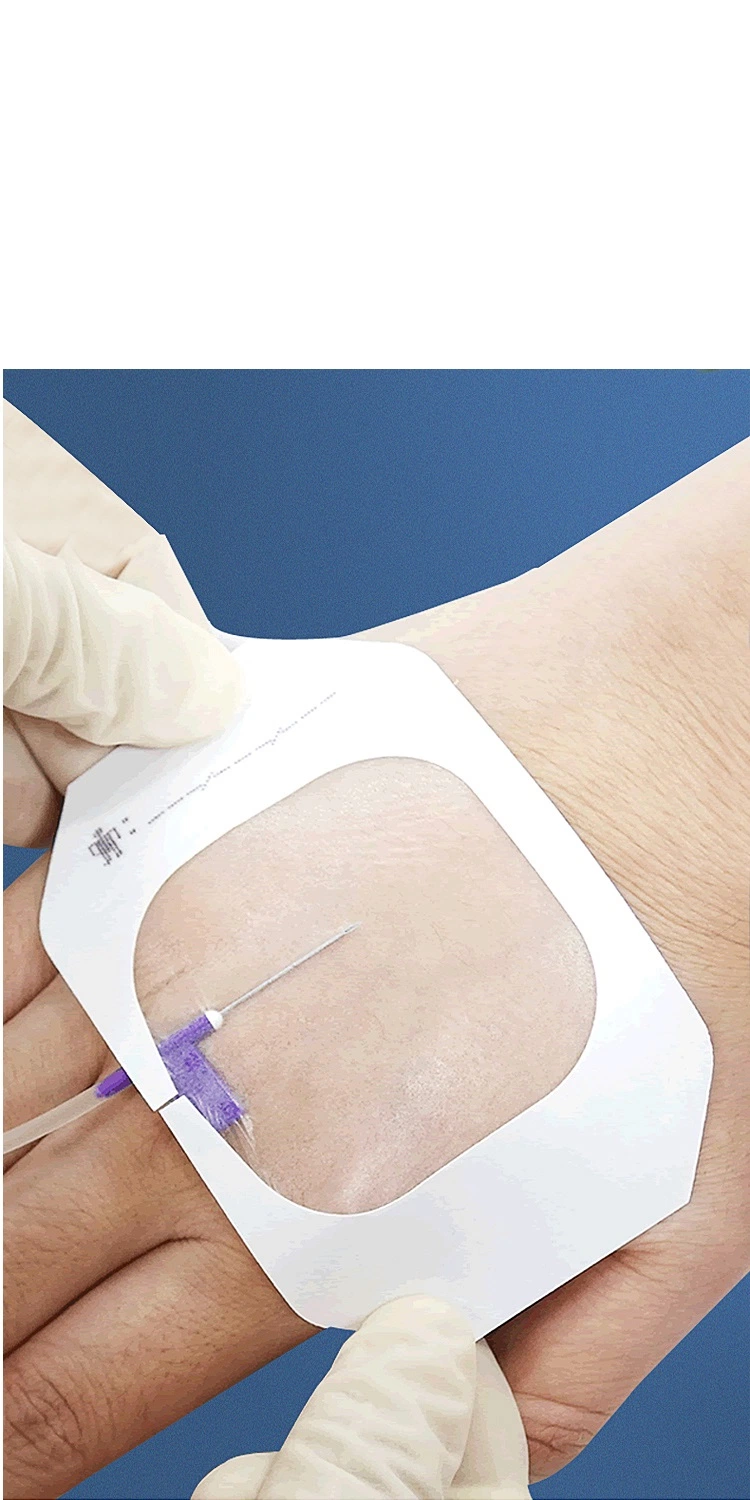 Disposables IV Cannula Fixing Dressing for Operation Traumatic Wound