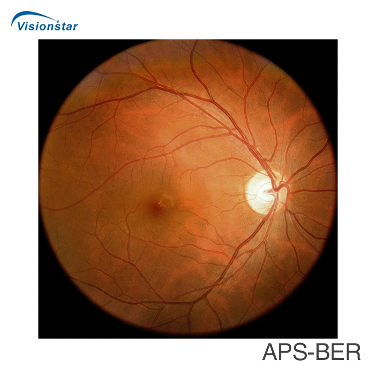 High quality/High cost performance  Auto Focus Automatic Fundus Camera