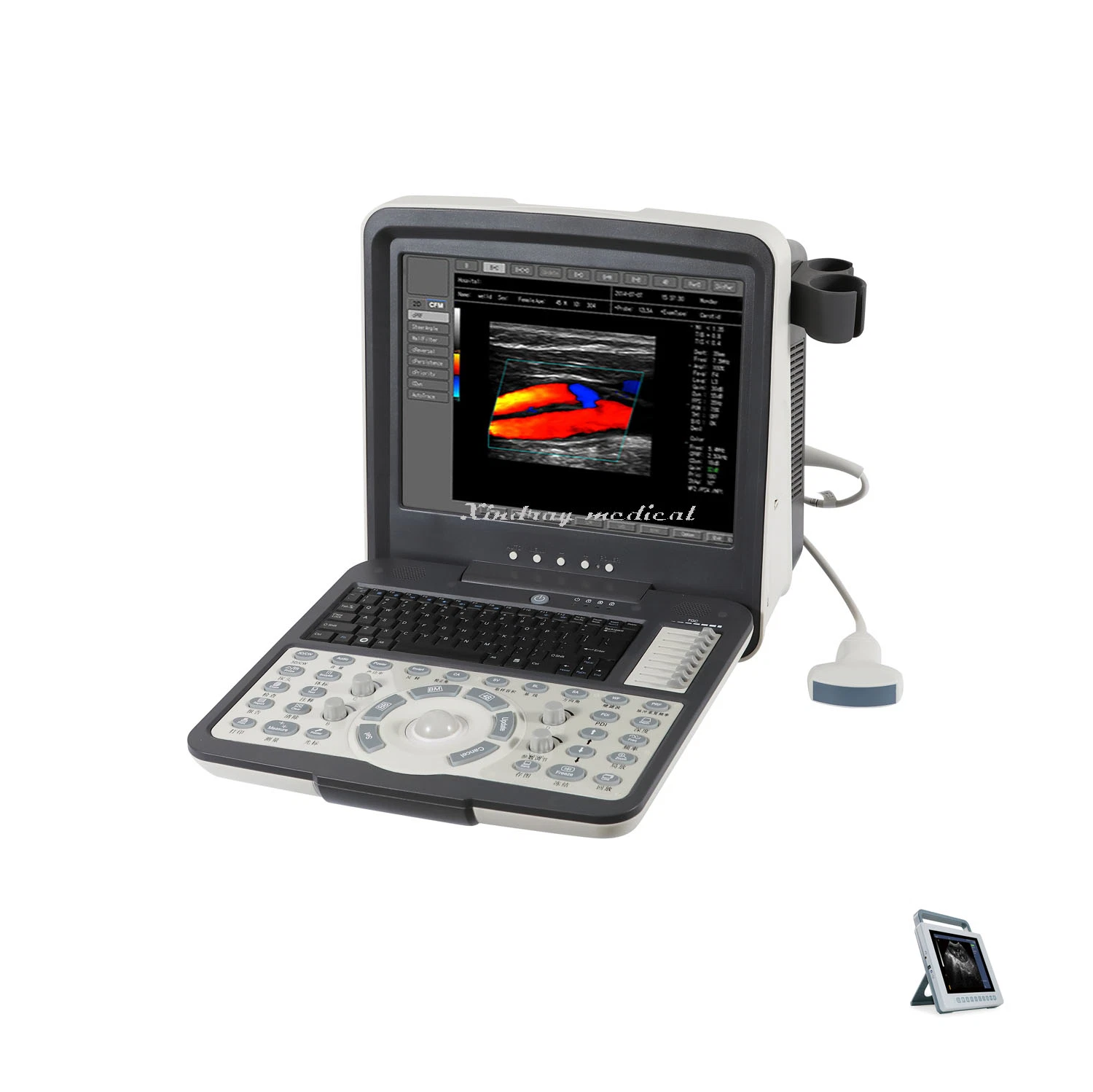 Cheaper Price with Probe Medical Digital Ultrasound System, Portable Laptop Ultrasound Scanner