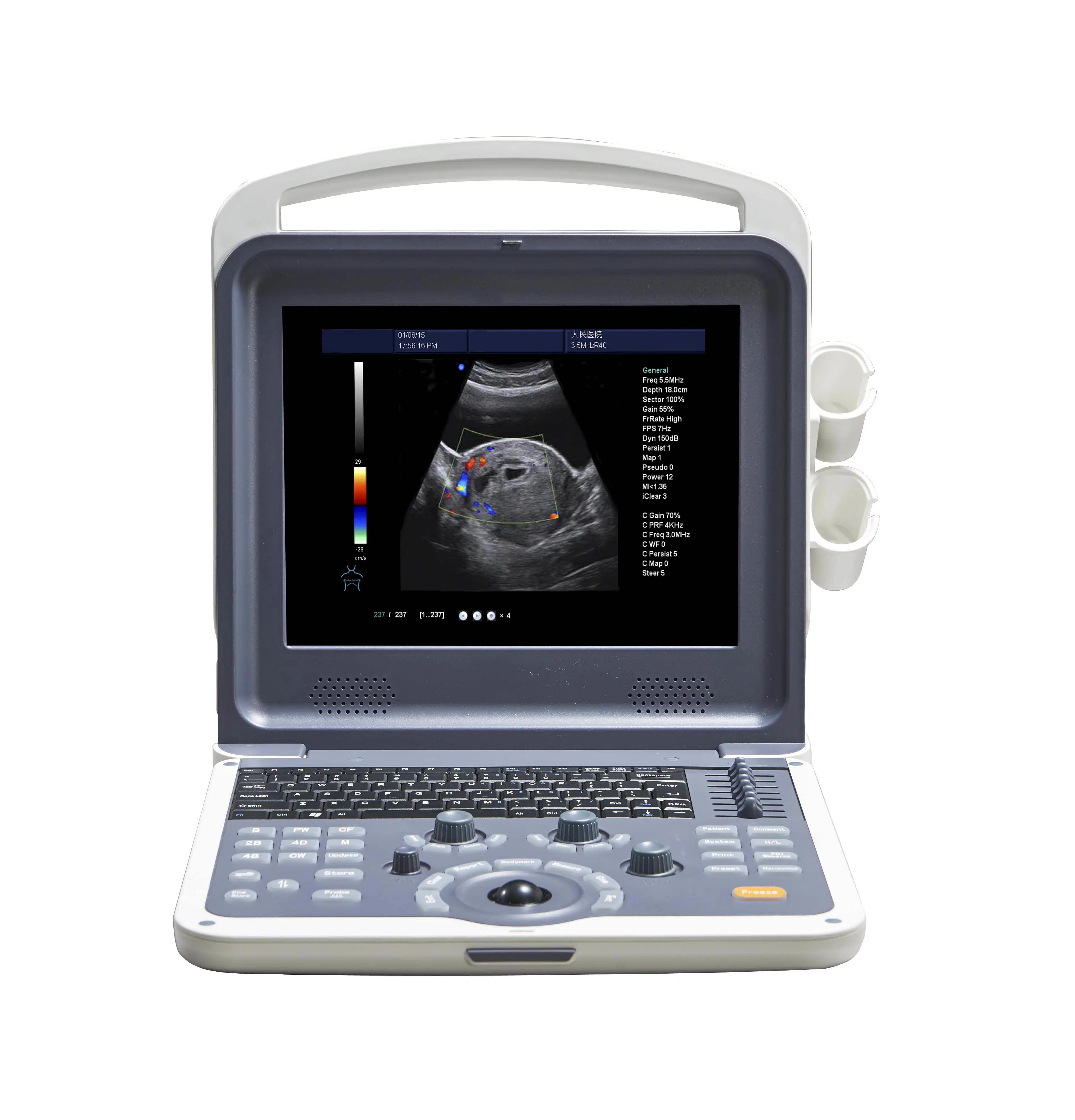 Portable Color Doppler Ultrasound Scanner for Cardiology