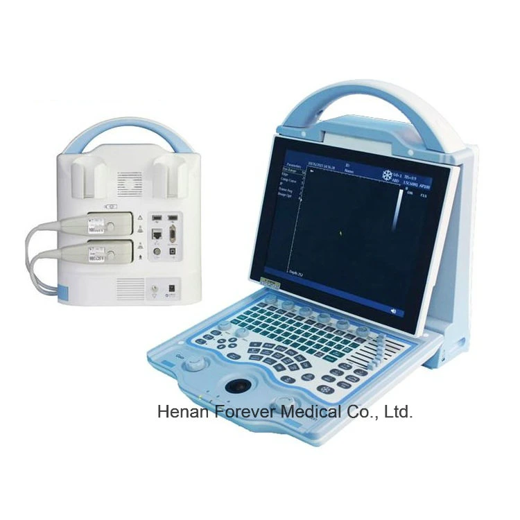 B/W Diagnostic Ultrasound Scanner System with Factory Price