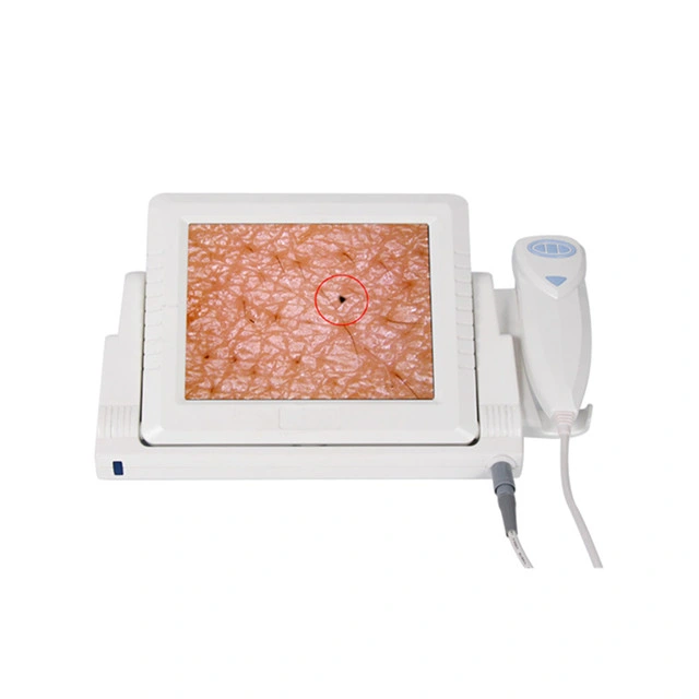 Professional 2 in 1 Skin Hair Analyser Machine for Beauty Salon Use