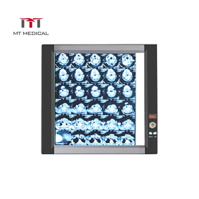 Light-Adjustable Medical X Ray Film Viewer LED Screen