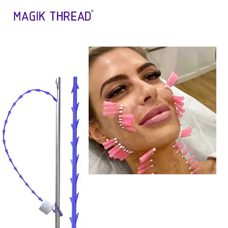 Eliminar las arrugas más médicos rosca Magik Fios Pdo Cog Lifting Facial 4D Pdo Thread