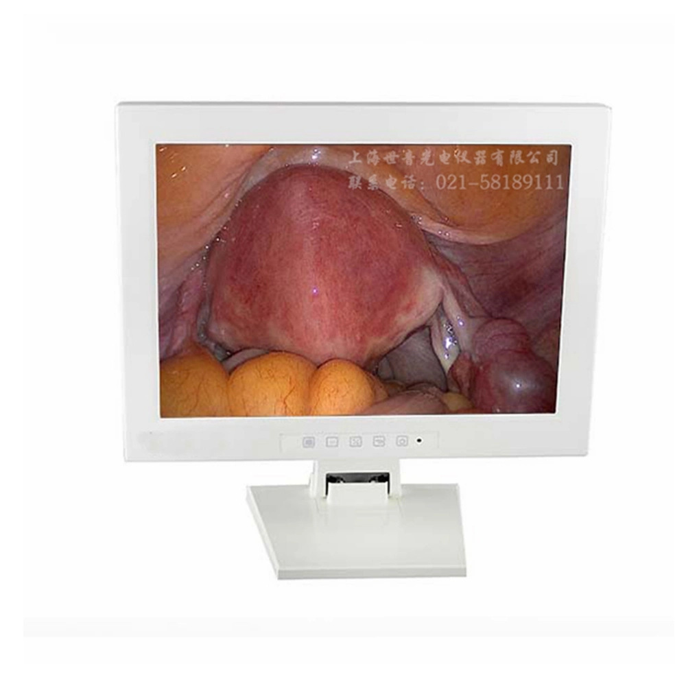 Anorectal Endoscope Instruments for Surgery and Examination with Cdd/HD Camera