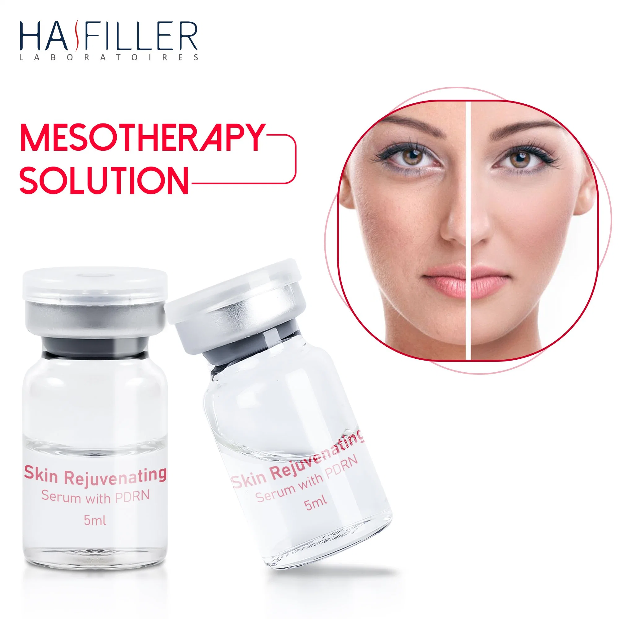 Hochwertige Reparatur Haut Sonnenschäden Haut Verjüngen Serum Pdrn Injection Mesotherapie Serum