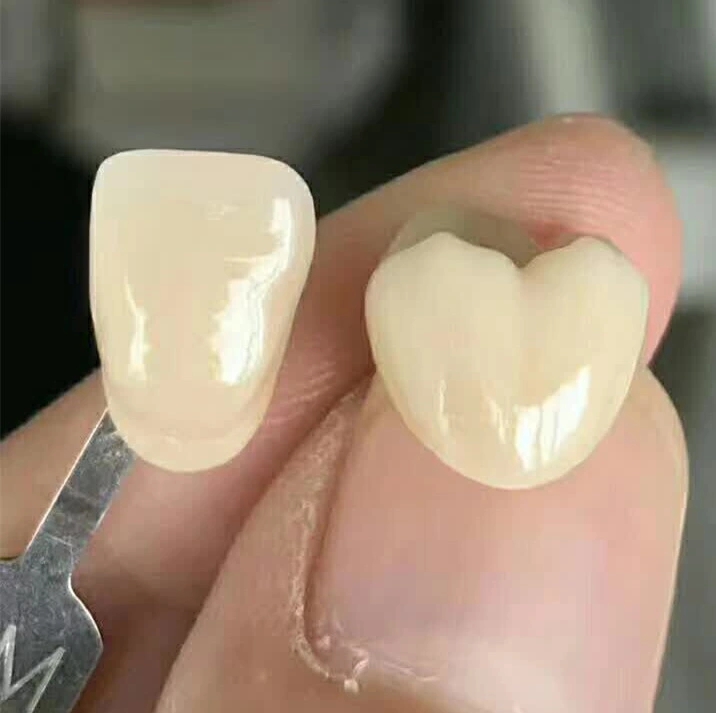 Personalizable multicapa 3D Pro Zirconia Dental estética Material Resteration disco