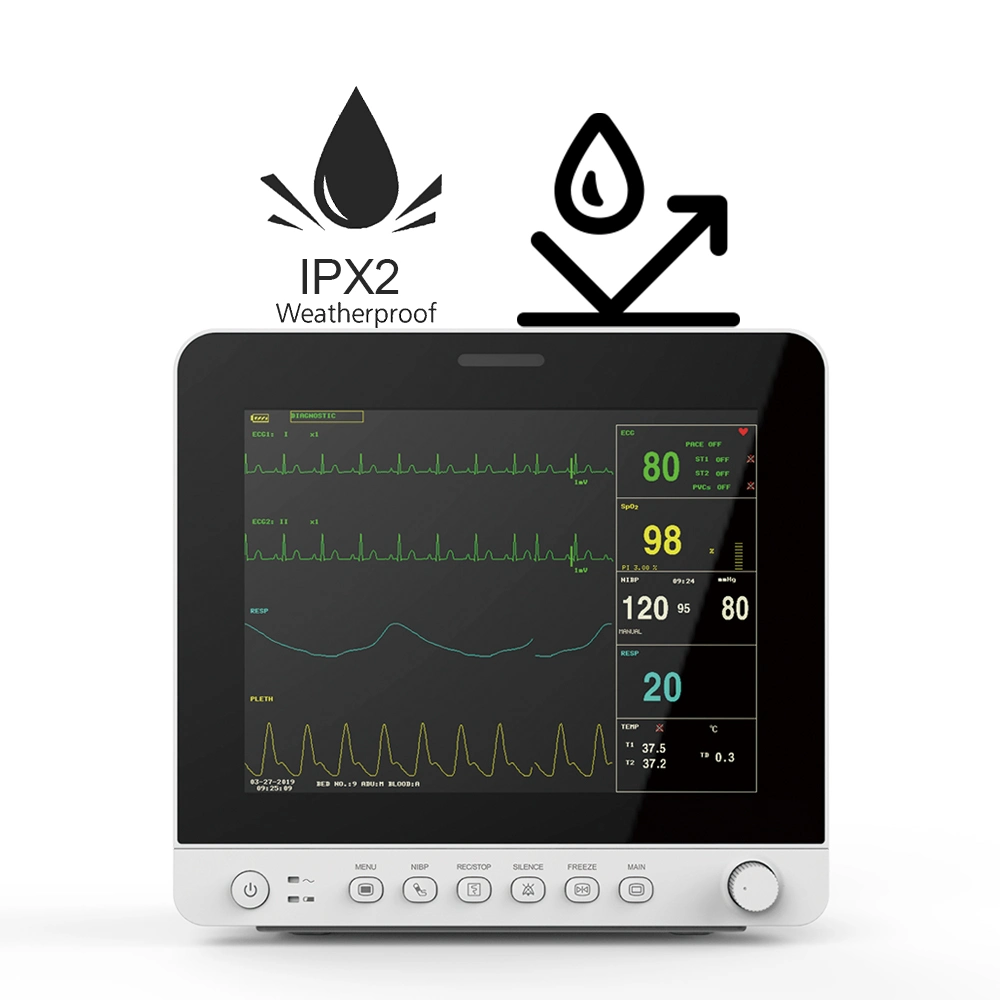 Monitor de paciente de ECG de 12 derivaciones Contec Cms8000-1 con certificado CE