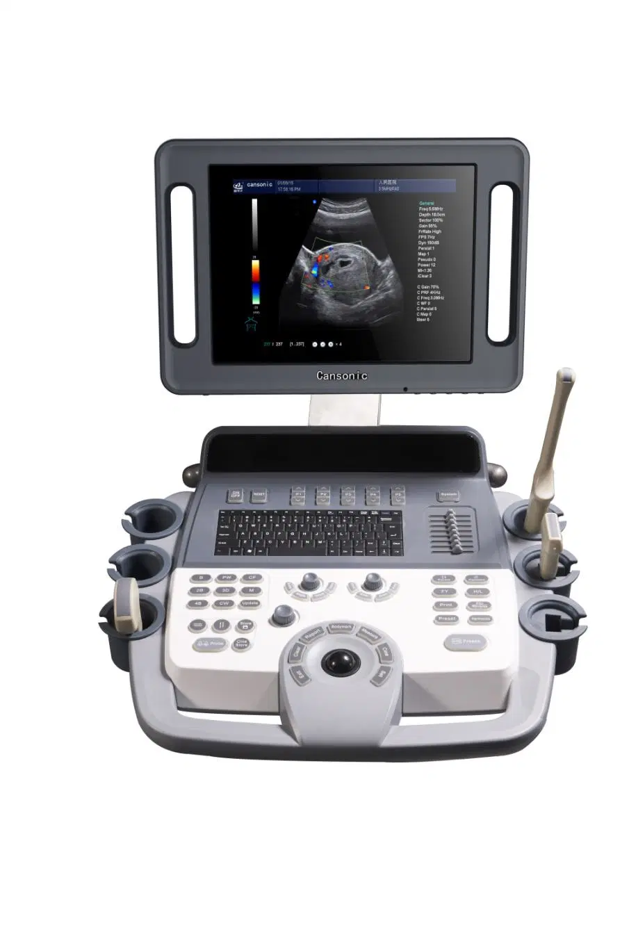 Hospital Ysb-K100 Trolley Color Doppler Ultrasound Medical Equipment