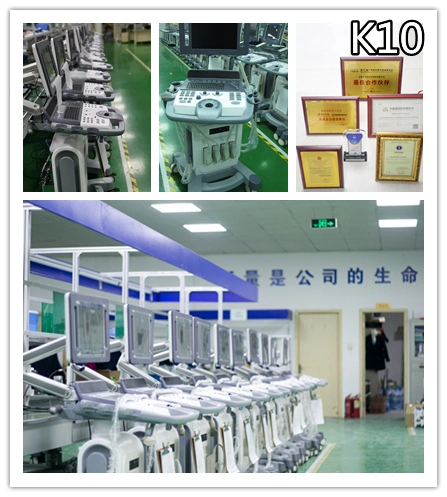 Hot Sale Trolley Color Ultrasonic Dignostic System