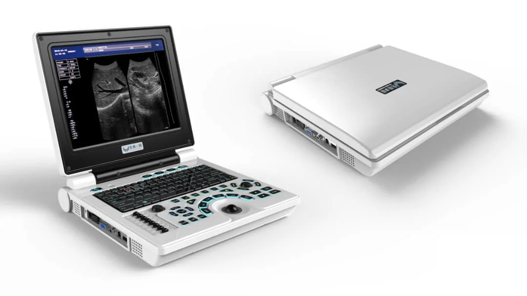 Laptop Ultrasound Scanner for Human & Veterinary Xf30b