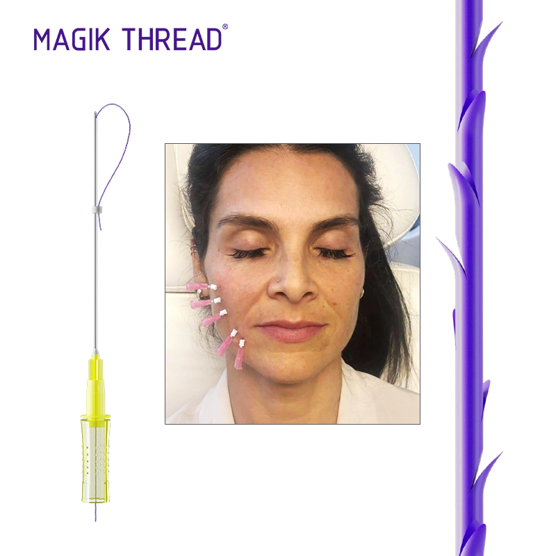 Magik Thread Korea Cog 4D Fish Bone Thread Eyebrow Forehead Lifting Pdo