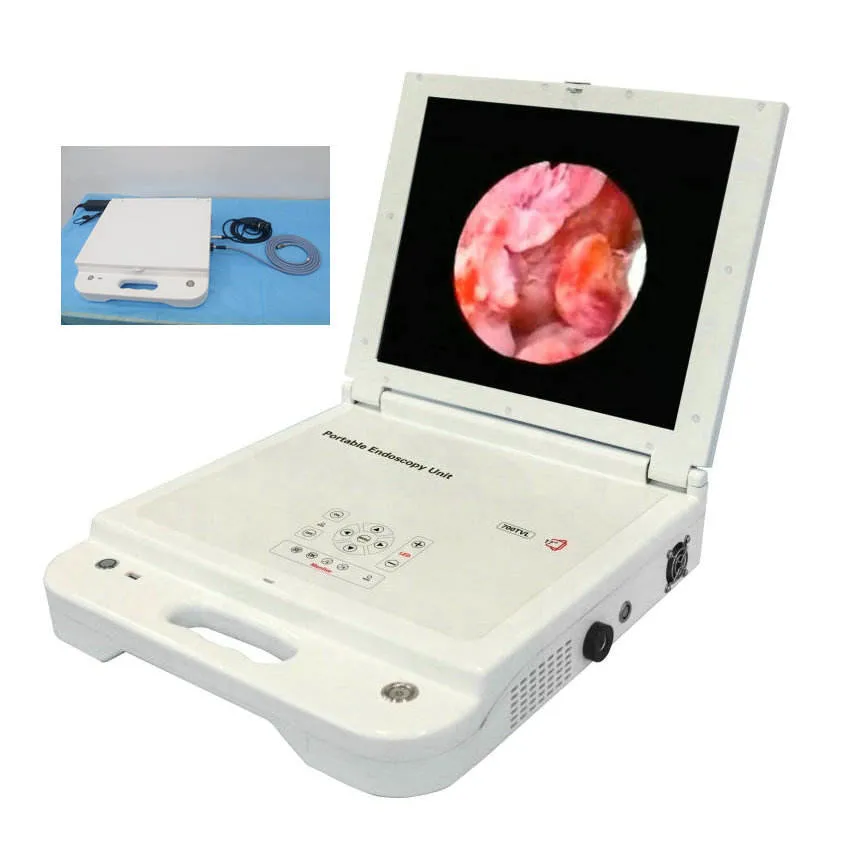 Système de caméra endoscopie médicale moniteur Ent HD portable appareil photo endoscope Unité