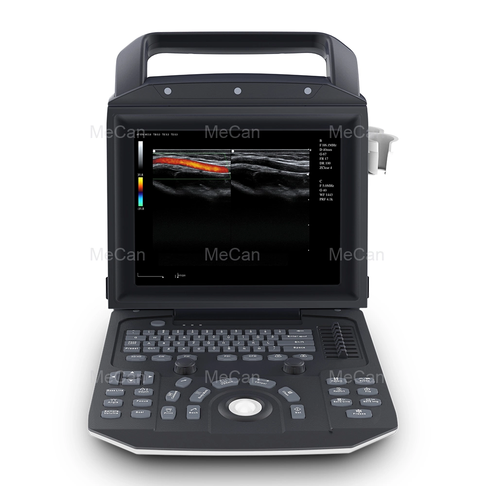 Appareils d'échographie de chevet Doppler instruments d'échographie médicale portables linéaires