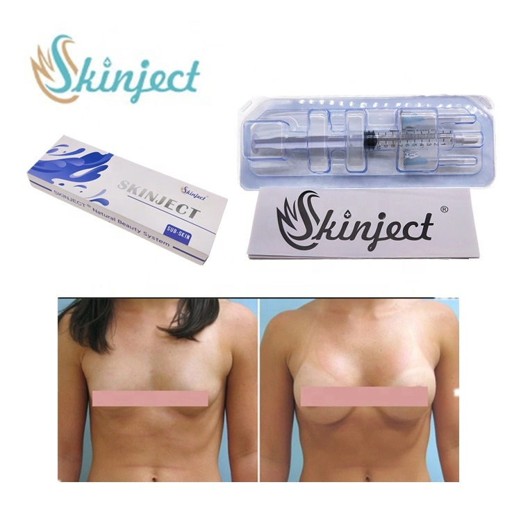 Wholesale/Supplier Injectable Dermal Fillers Breast Injectable Breast and Buttock Hyaluronic Acid Injection Dermal Fillers