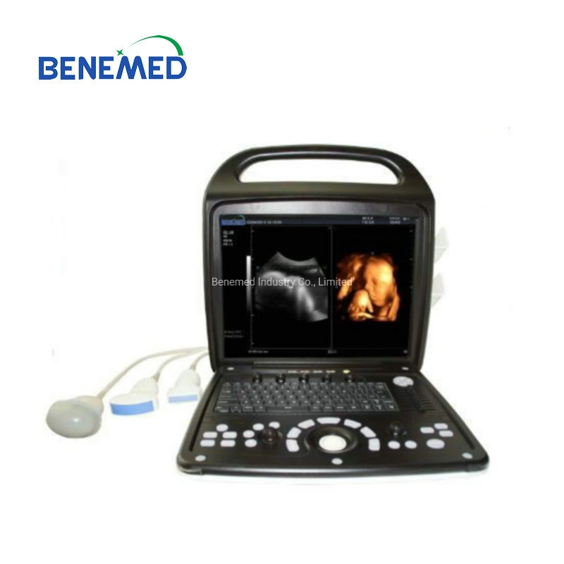 Premium 4D Color Doppler Ultrasound Scanner Diagnosis Equipment