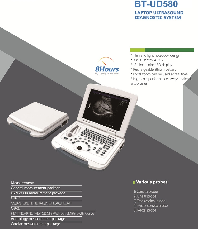 B/W Ob Gyn Urology Vascular Msk Ultrasound Scanner Digital Laptop Ultrasonic Equipment to Human