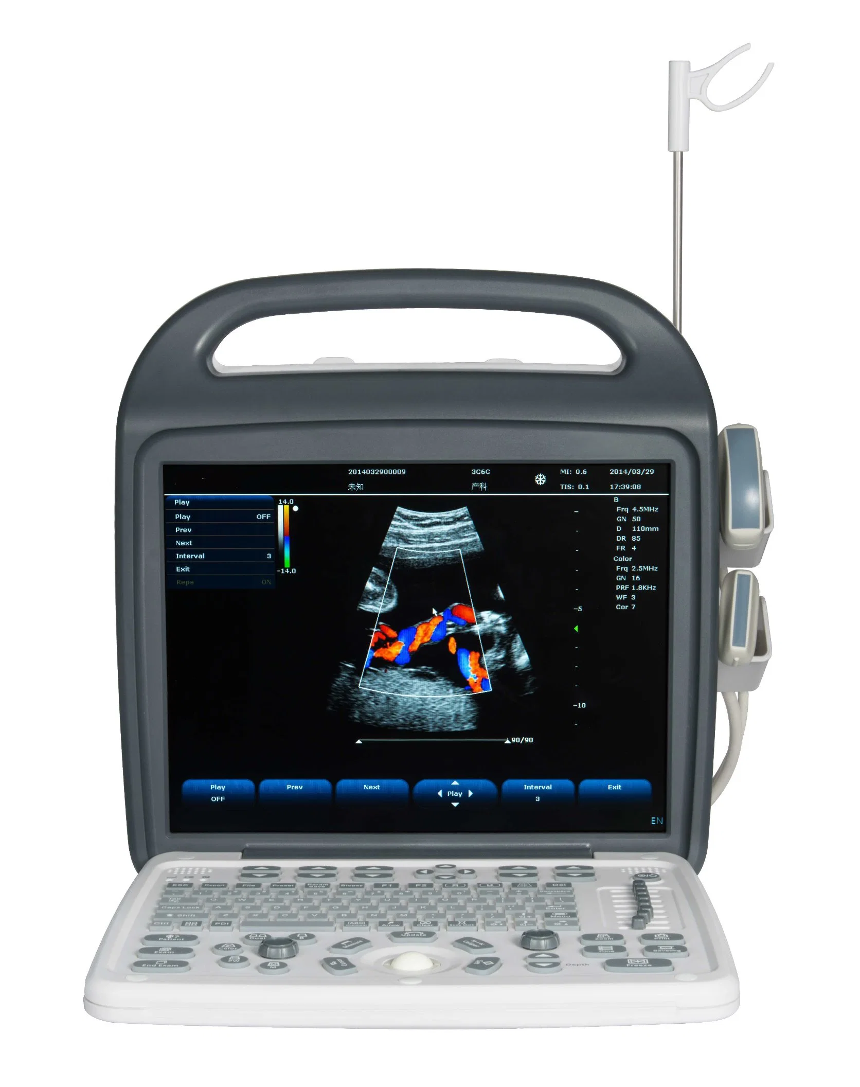 Portable Colour Doppler Ultrasound Scanner in Hospital