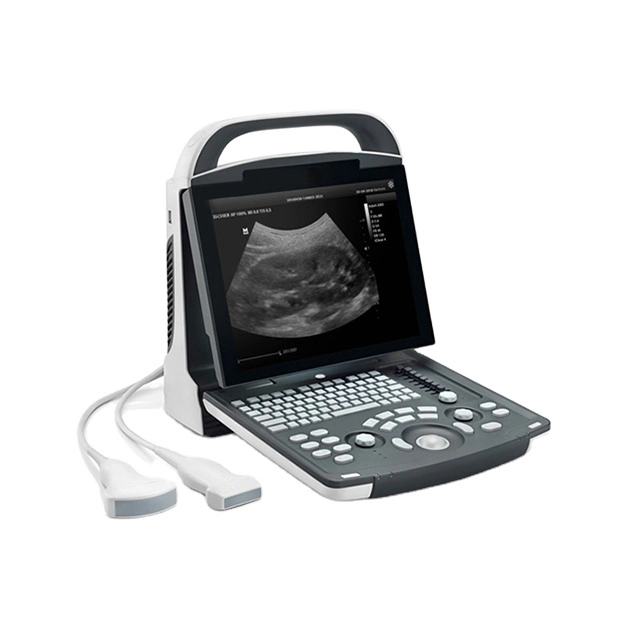 Portable Mindray Colored Doppler Ultrasound Machine Prefessional Digital Dianostic Medical Equipment Ultrasound Scanner