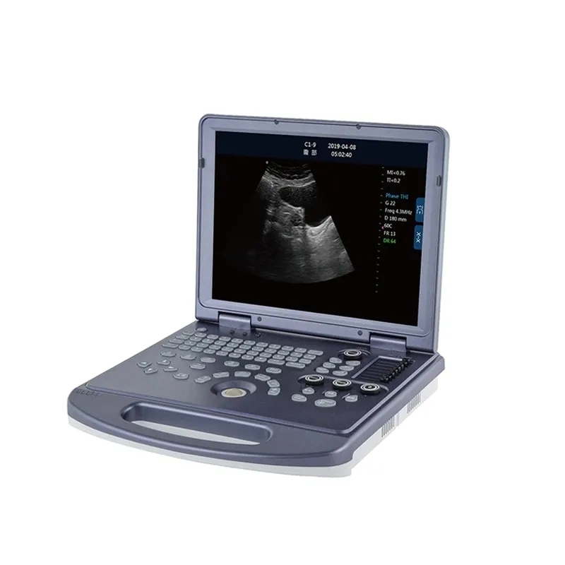 Medical B/W Portable Ultrasound Machine with Cheap Price (THR-USC60)