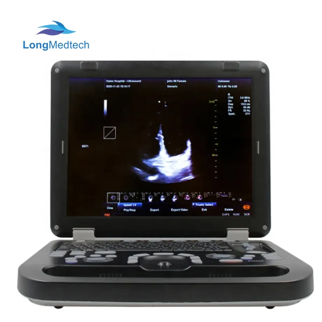 Vet Clinic Use Color Ultrasound Color Doppler Machine Portable Vets Healthcare Check Medical Ultrasound Equipment