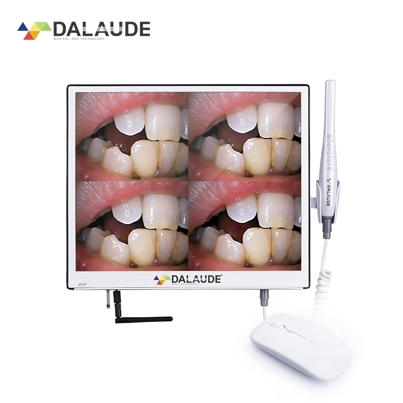 2022 Best Digita Iris Intraoral Camera China Suppliers with Patented Ultra-Thin Display