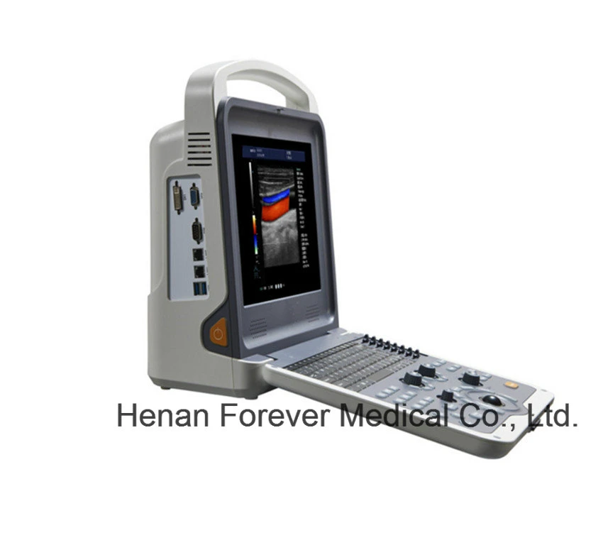 Medical Cardiac Doppler Color Ecógrafo 4D Digital