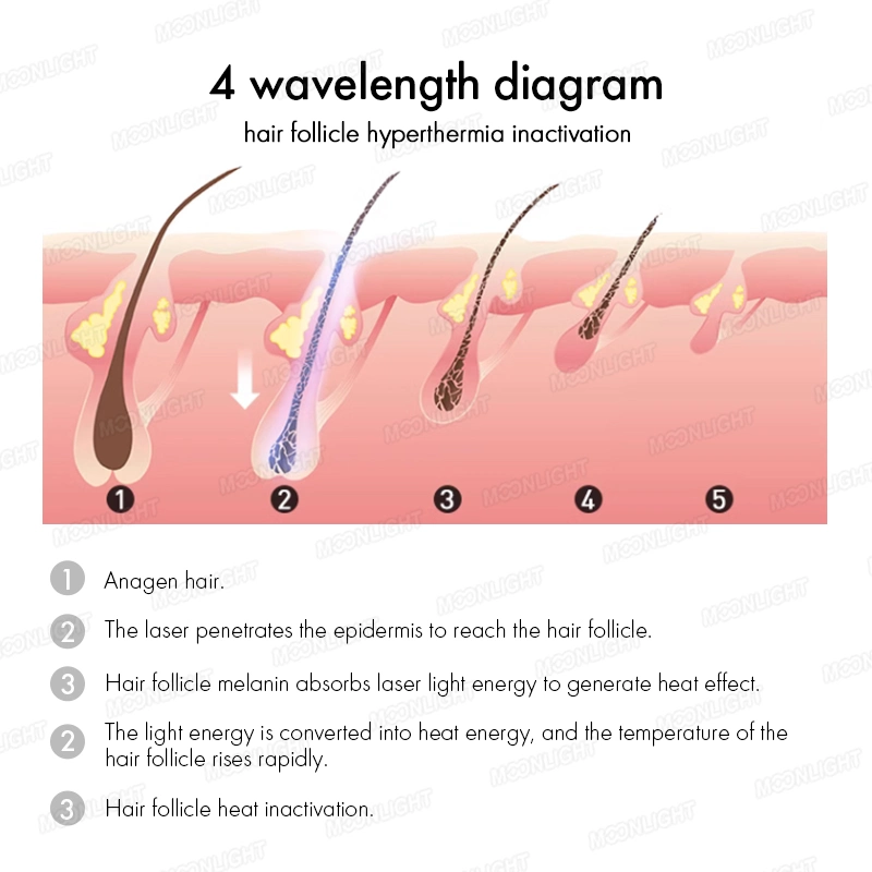 الصمام الثنائي الليزر آلة إزالة الشعر شعار المصنع الأصلي للمعدة الطبية FDA