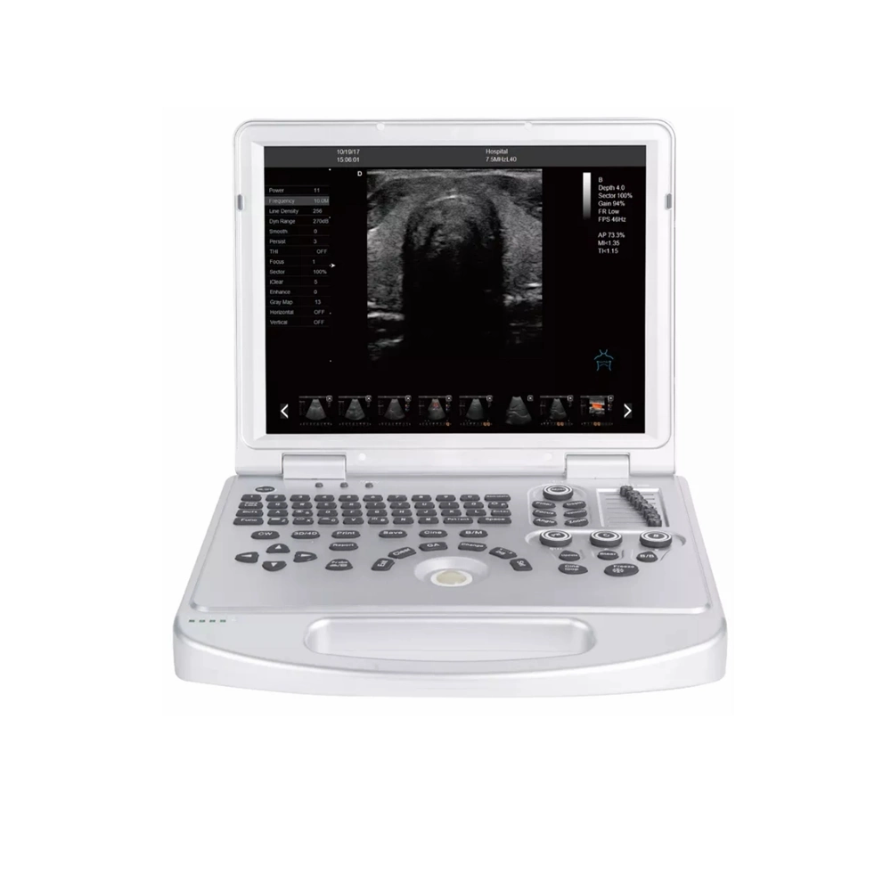 Ultrasound Scanner Portable Color Doppler 3D Portable Ultrasound Machine for Clinic and Hospital