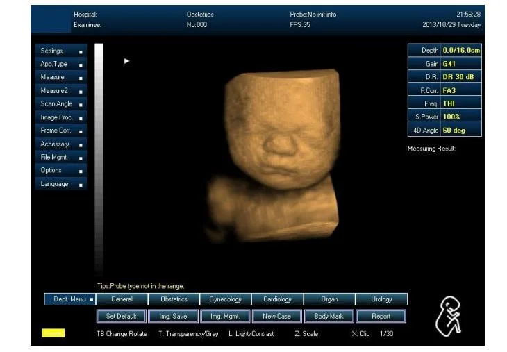 ISO CE-Zulassung Digital Portable 2D 4D Farbdoppler-Echo Ultraschallscanner Der Maschine