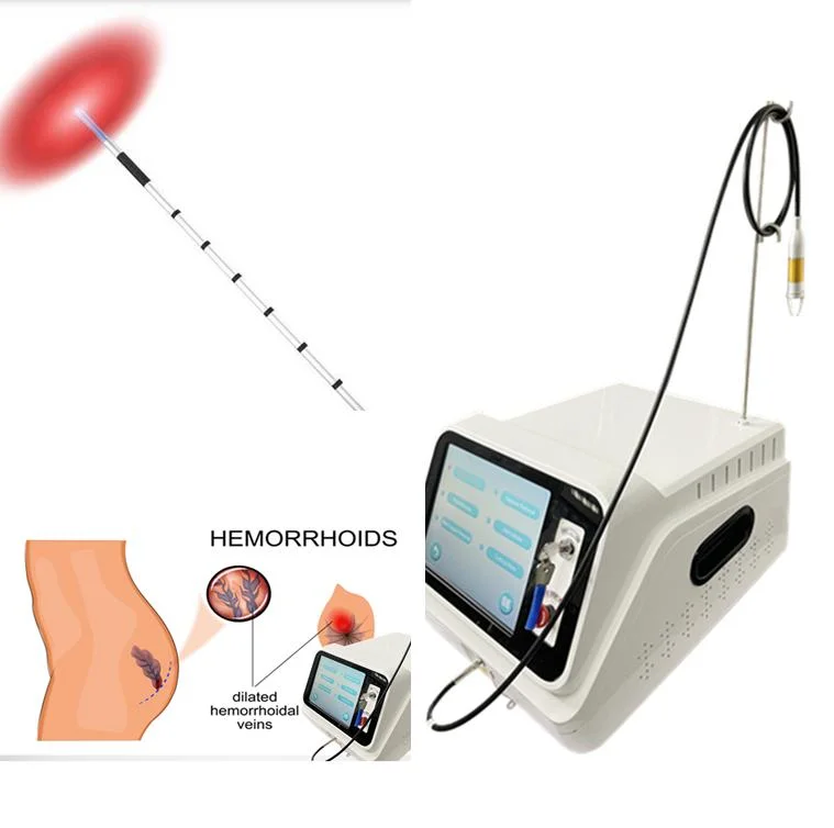 980 +1470нм многофункциональный Pldd простаты свай и анал фистула хирургия варикозное расширение вен лазерного диода крестовина ключе снятие машины