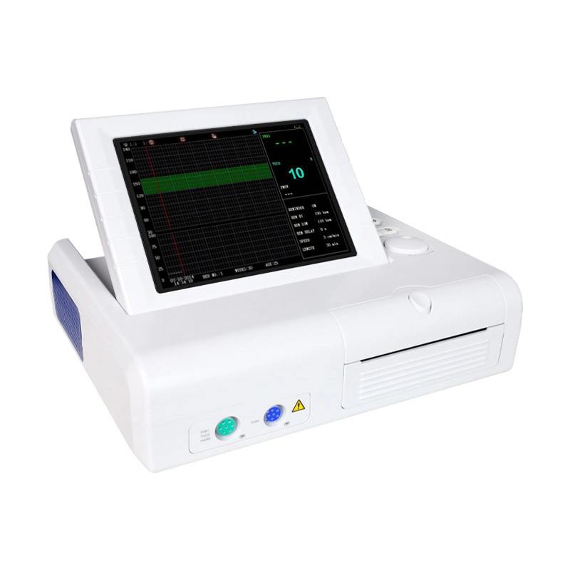 Contec Ce Cms800g Monitor Fetal Ultrasónico de Bebé Ritmo Cardíaco Movimiento del Feto Marca Sensor Toco Máquinas Ctg