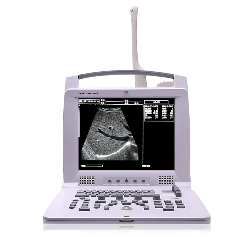 My-A004A Medical Products Portable Laptop Ultrasound Scan for Human or Veterinary